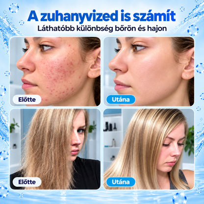 Bőrmegújító Zuhanyfej
